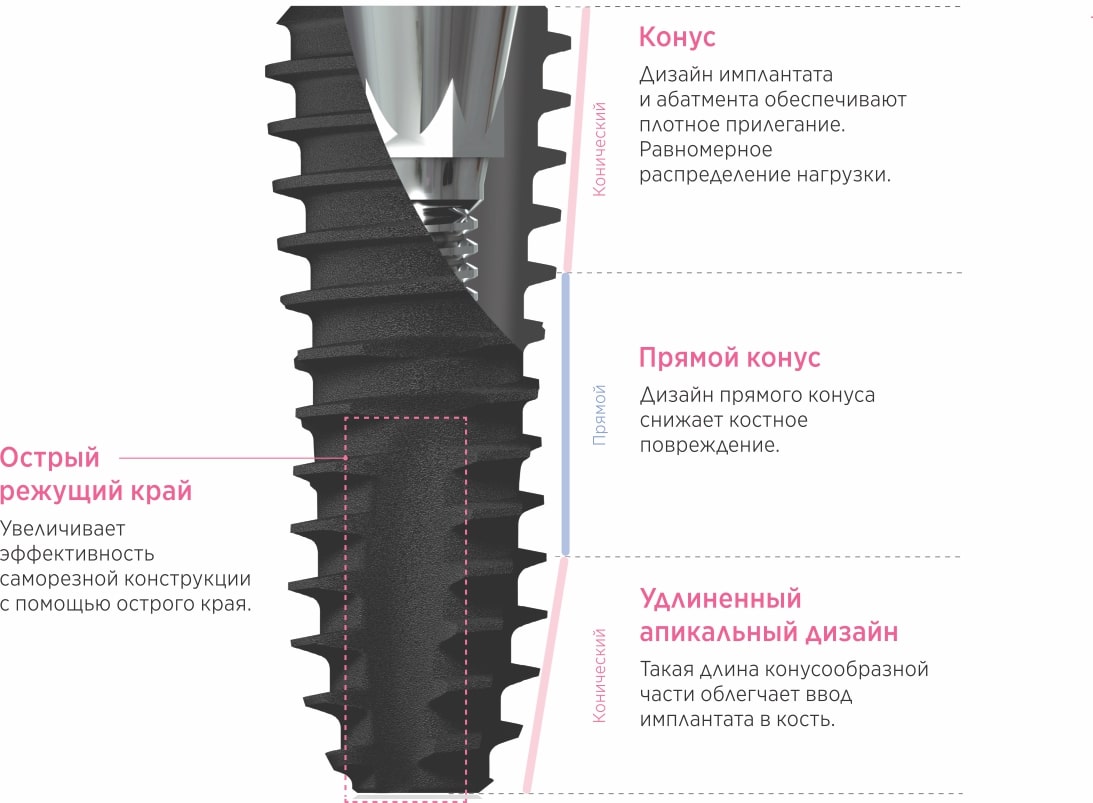 uf implant