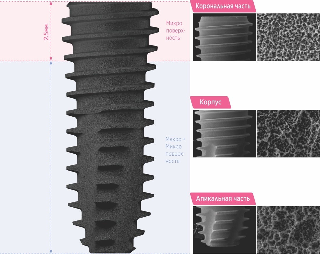 uf implant